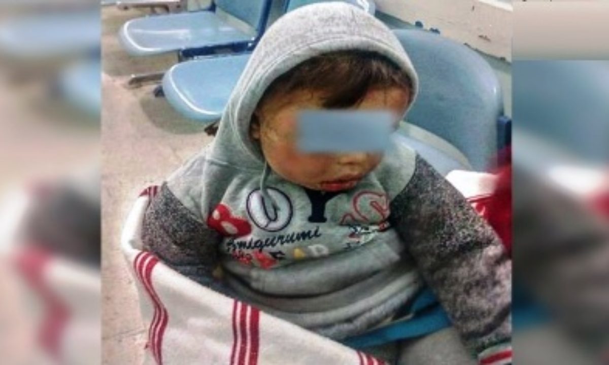 Tunisie Sousse L Hopital Declare L Admission D Un Bebe Maltraite Par Sa Mere Tunisie