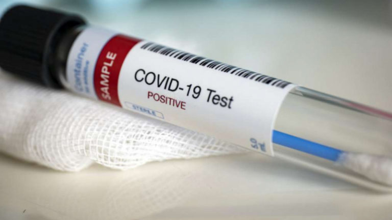 Coronavirus: 12 nouvelles contaminations au kef