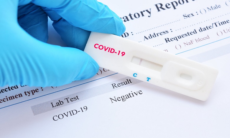 Coronavirus : Les pharmaciens appellent à autoriser la vente des tests rapides dans les pharmacies